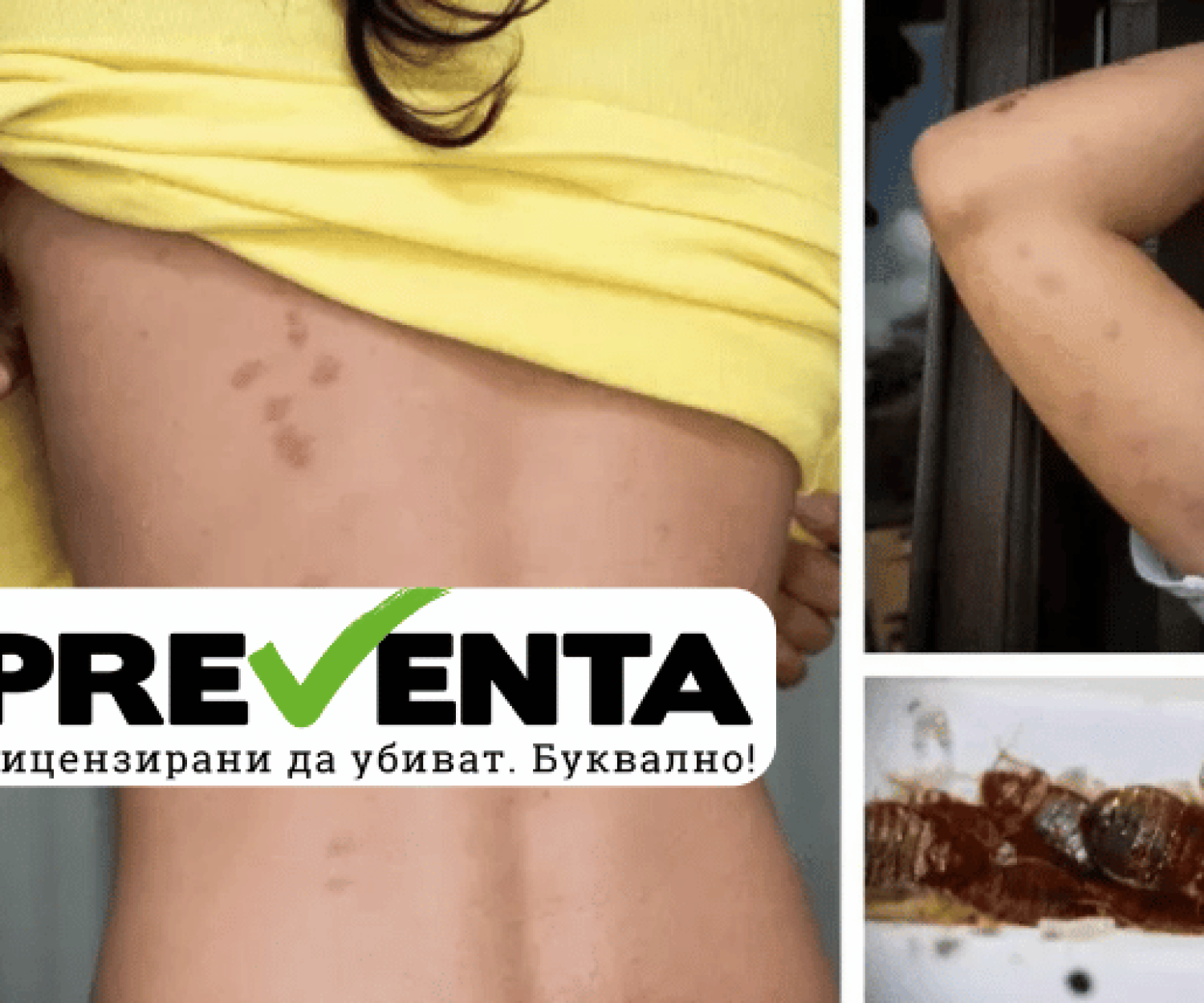 Как да се лекуваме от ухапване от дървеници: Ефективни методи и съвети