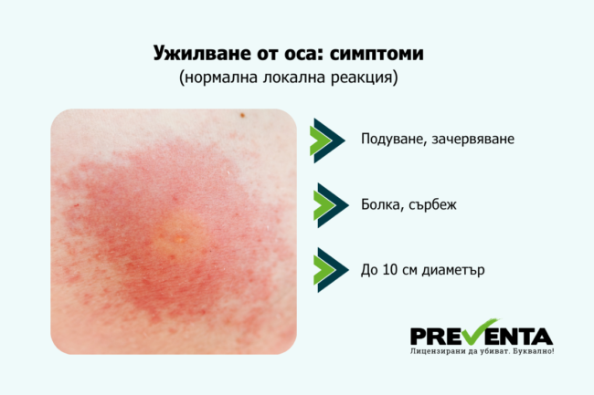 Ужилване от оса - ето как обичайно изглежда нормална локална кожна реакция.